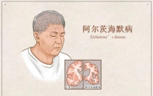 老年人记忆力不好就是老年痴呆吗,老年人记性越来越差是老年痴呆吗