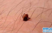 真实的蜱虫叮咬后伤口图片，蜱虫叮咬会致命小心处理