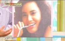 韩国整容电风扇脸,美容毁容的韩国女星