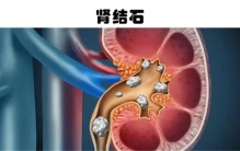 眼睛受到灼伤有多痛 人类所能经历的5件最严重的痛苦