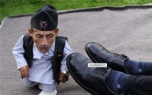 世界上最小的人排行榜前五名 因为疾病而变得矮小