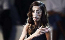 世界最丑骷髅女孩丽兹·维拉斯奎兹，每天吃60顿饭却零脂肪