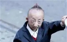世界小矮人何平平,世界第一矮人身高排名