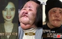 韩国电风扇阿姨韩慧景去世 整容前后对比照曝光