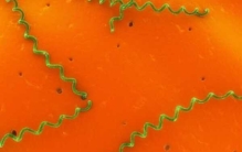 人类最容易得什么病?最容易患的10种疾病大盘点