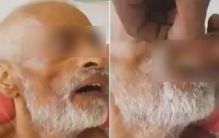 人的伤口为什么会长蛆「为什么人受伤动不了的时候身上就会长蛆虫卵到底是哪里来的」