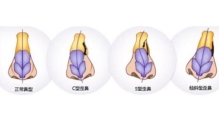 鼻子丑毁一张脸,最丑的四种鼻型是什么