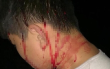 肥城俩同学闹矛盾家长助拳惹事端