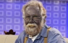 世界上最奇异的蓝种人：具有蓝色皮肤的人种(基因变异)