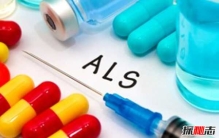 渐冻症会遗传下一代吗?渐冻人最典型的十大症状