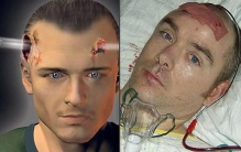 空腔效应为什么致命，空腔效应有救吗/造成永久性创伤