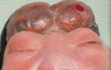 出生缺陷包括哪些病?不常见的10大新生儿出生缺陷(太痛苦)