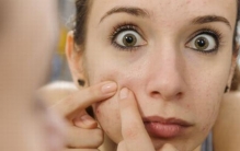 脸颊两侧长痘的原因是什么?脸颊长痘怎么调理