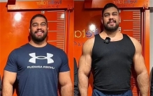 为取悦男友，德国女子花百万做2次断骨增高手术，结果怎么样了？