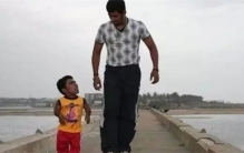 世界十大袖珍人 排第一的仅54.6厘米