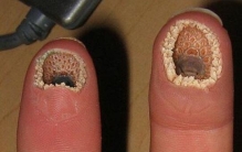 十大手贱不能搜的词条，莲蓬乳和空手指秒杀微笑狗(恶心)