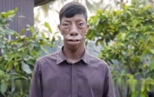 脸部遗传病,男孩身体变得诡异发出瘆人的怪笑