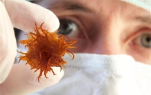 关于癌症的新研究 如何破坏癌环境（抗击癌症）