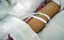 拔火罐 死亡,女子拔火罐脖子很受伤