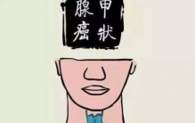 唯一不影响寿命的癌，甲状腺癌（不影响寿命/可活到老死）