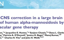脑残有得治首例基因载体AAVhu32可矫正全脑的基因缺陷