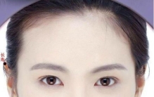 痣相图解大全 女脸上,女性脸上痣图