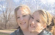 连体人最多活多久?关于连体双胞胎的十大真相