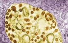 世界上最可怕的病毒，马尔堡病毒致死率高达95%