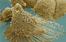 给癌细胞供养70年会怎样？已故黑人女性的癌细胞已分裂达5000万吨