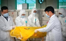 为什么会有尸臭,活人身上会有尸臭吗