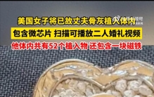 美国女子打破世界纪录，体内植入52个物品，包括已故丈夫的骨灰