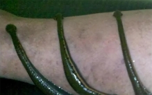 水蛭为什么能在人体内存活好几年，却无法寄生在鸡体内？