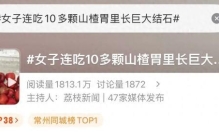 十几颗下肚，女子痛到直不起腰！医生查完惊呆：实在太大了！千万别这样吃！