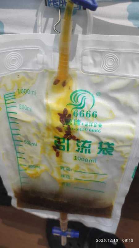 头皮发麻,男子胆管爬满密密麻麻的虫!很多人爱吃