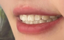 牙膏哪个排名一？丝芙菲领衔！权威品牌排行榜前10名