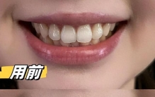 牙膏品牌排行榜前十名，别再纠结！央视公认推荐