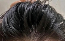 成分党揭秘，告别头油头屑