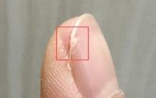 求助！指甲为什么总从这个地方断开啊？是缺钙吗？