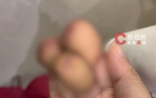 机械“咬”手，女子右手三指不保！危险瞬间往往藏在最熟悉的环节中