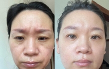 2026抗皱护肤品十大排名，公认好用的一线大牌汇总