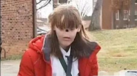 人类史上令人震撼的9个“奇异人类”！其中一个竟然有两个命根