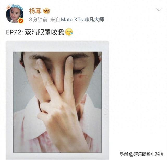 杨幂烫伤自拍刷屏：EP72 藏了内娱 12 年的清醒
