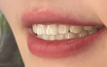 牙膏哪个牌子好？口碑最好的十大品牌排行榜揭晓