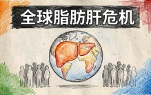 全球13亿人脂肪肝，你可能在其中