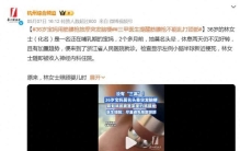 千万别用筋膜枪按这里！有人已经脑梗了，很多人还在天天做