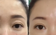 抗皱精华排行榜实测！25+敏皮亲测，终于避开所有坑