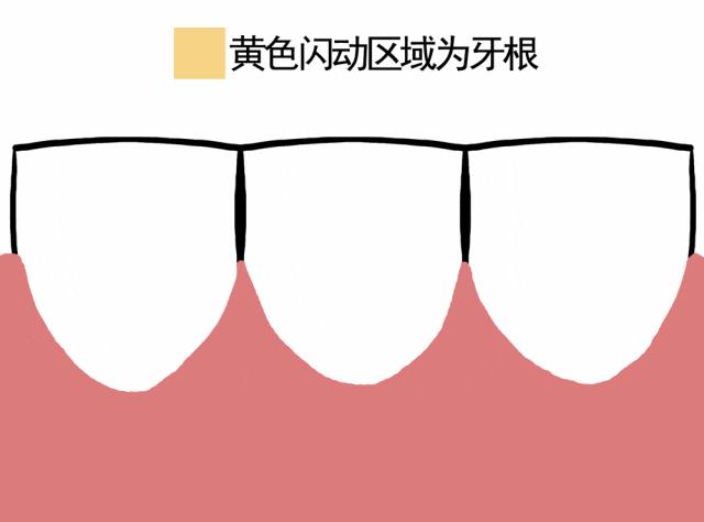 经常出现这种情况 可能是牙齿在“求救”！千万别大意