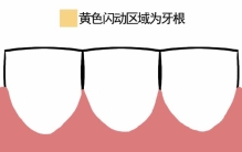 经常出现这种情况 可能是牙齿在“求救”！千万别大意