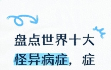 盘点世界十大怪异病症，症状奇特至今难以完全破解