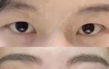 双眼皮整形机构排名前十，2026年性价比与口碑深度盘点